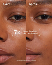 Duo Essentiel Anti-Boutons