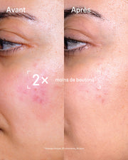 Duo SOS Imperfections